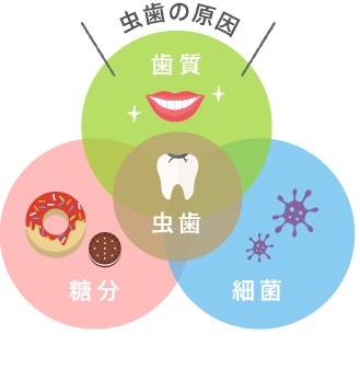むし歯の原因